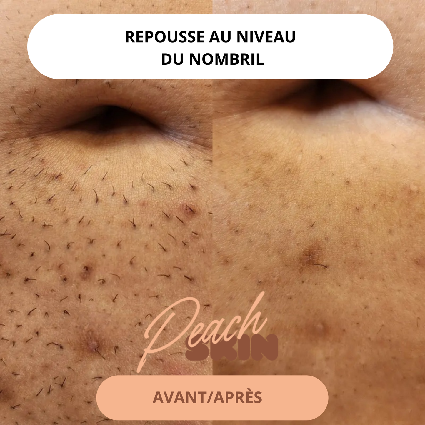 Rasoir PeachSkin